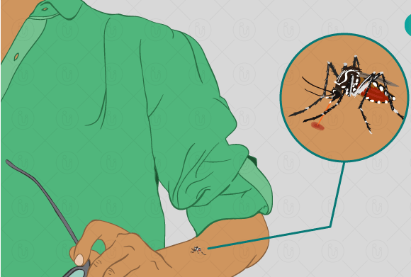 5 Triệu chứng sốt rét điển hình giúp bạn phát hiện sớm được bệnh