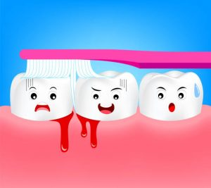 8 nguyên nhân gây chảy máu chân răng bạn không thể bỏ qua