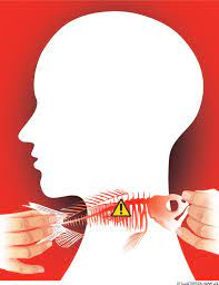mách bạn 9 cách trị hóc xương cá ở cổ họng tại nhà an toàn và hiệu quả