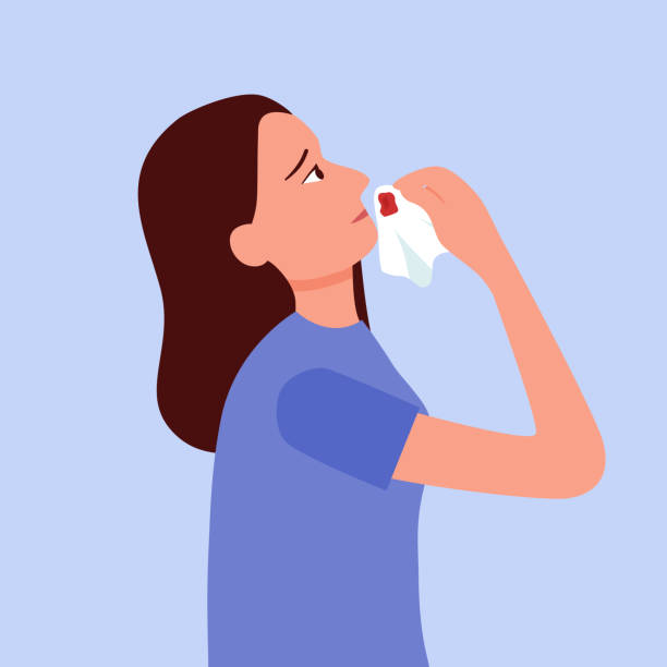 9 nguyên nhân chảy máu mũi và cách xử trí tại nhà bạn cần biết