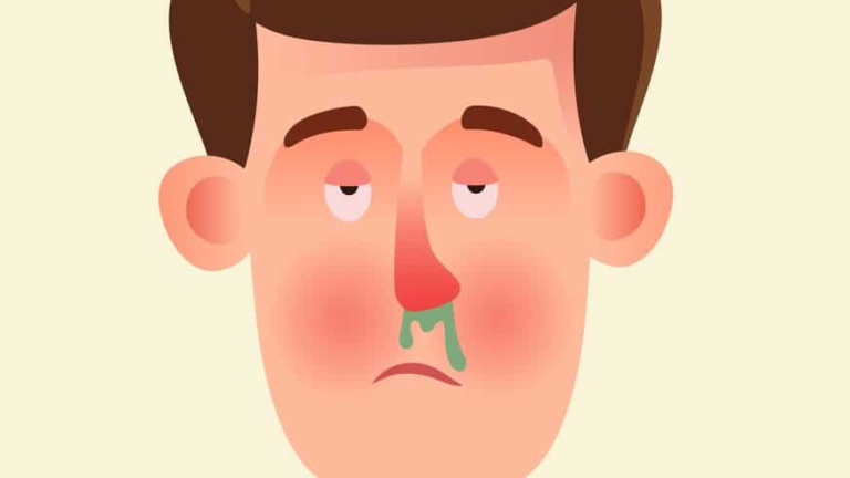 mách bạn 8 cách giúp ngưng chảy nước mũi hiệu quả tại nhà