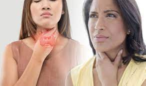 5 dấu hiệu ung thư vòm họng ở phụ nữ giai đoạn sớm bạn cần biết